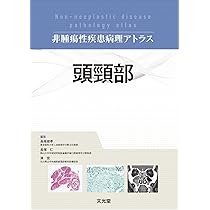 頭頸部 (非腫瘍性疾患病理アトラス) | 長尾俊孝, 長塚 仁, 湊 宏 |本